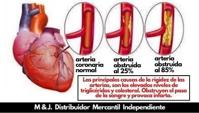 CORAZÓN, ENFERMEDAD CORONARIA Y la excelente Nutrición.