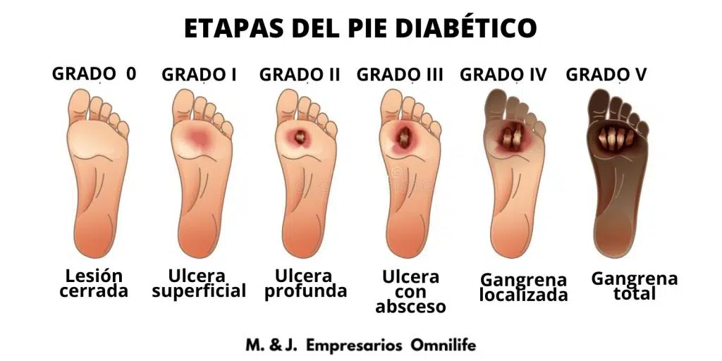 DOLCE VITA OMNILIFE. DESCUBRE SUS BENEFICIOS.